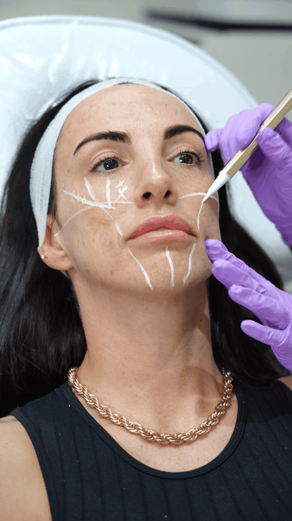 Aesthetic treatment result at Medcura Clinic Stanmore