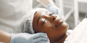 Acne Treatments in Stanmore