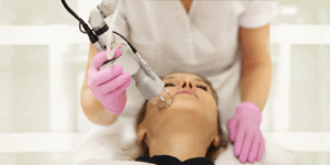 CO2 laser treatment in Harrow