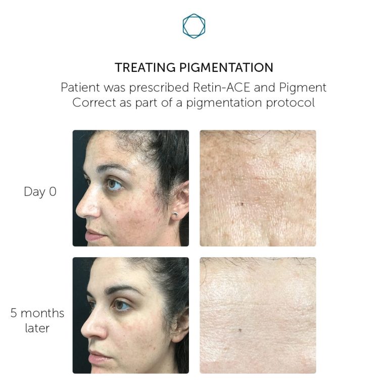 Pigment Correct - Image 3