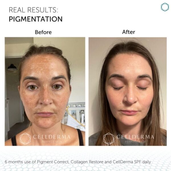 Pigment Correct - Image 4