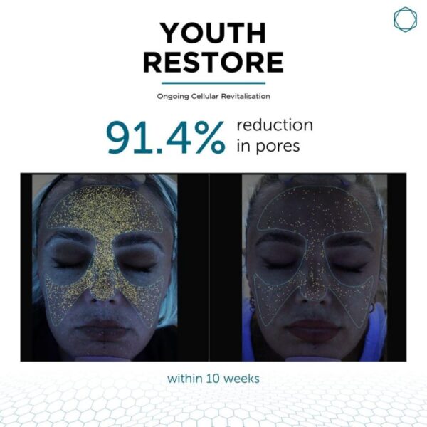 Youth Restore - Image 6