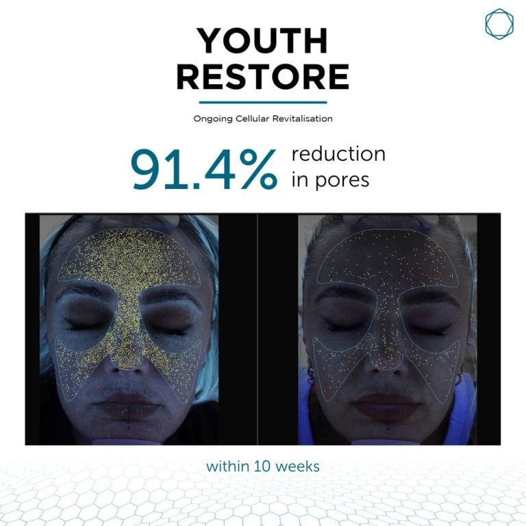 Youth Restore - Image 6