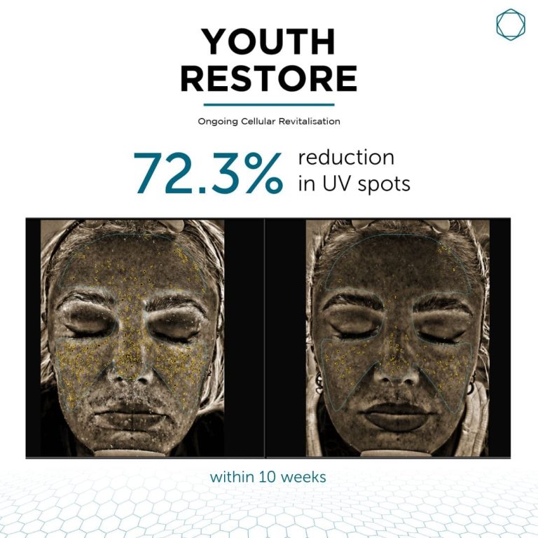 Youth Restore - Image 5