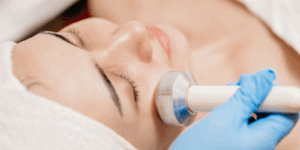 Face tightening in Stanmore