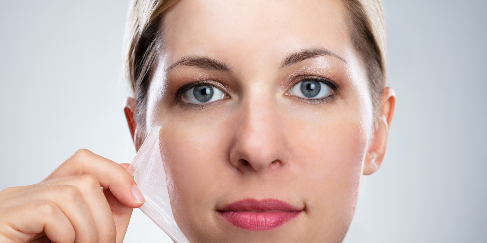 chemical peel harrow
