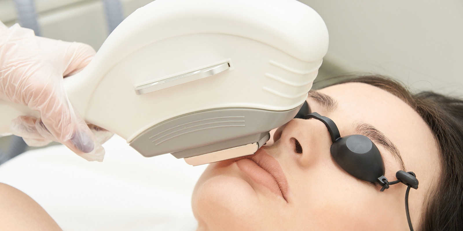 Blogs IPL Hair Removal in Harrow