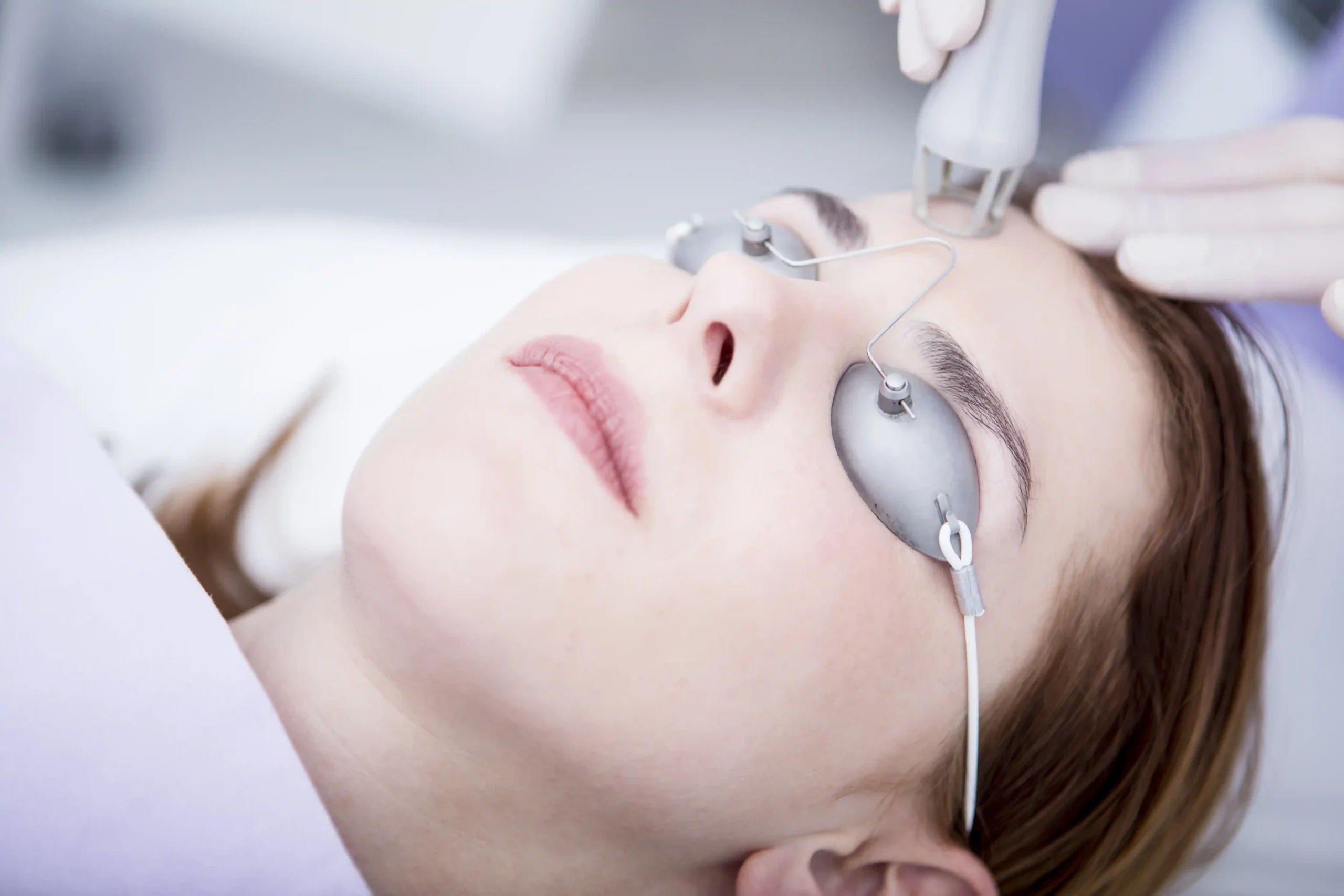 Co2 Laser Treatment in Greenford