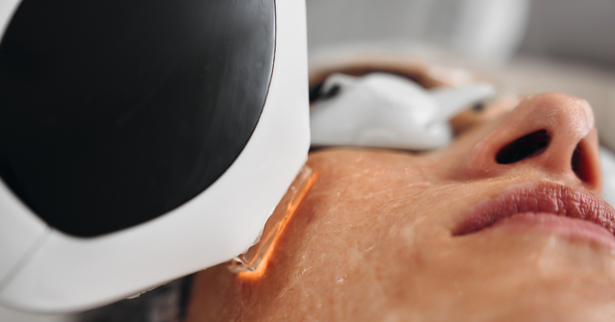 Blogs Co2 Laser Resurfacing Treatment in Southall