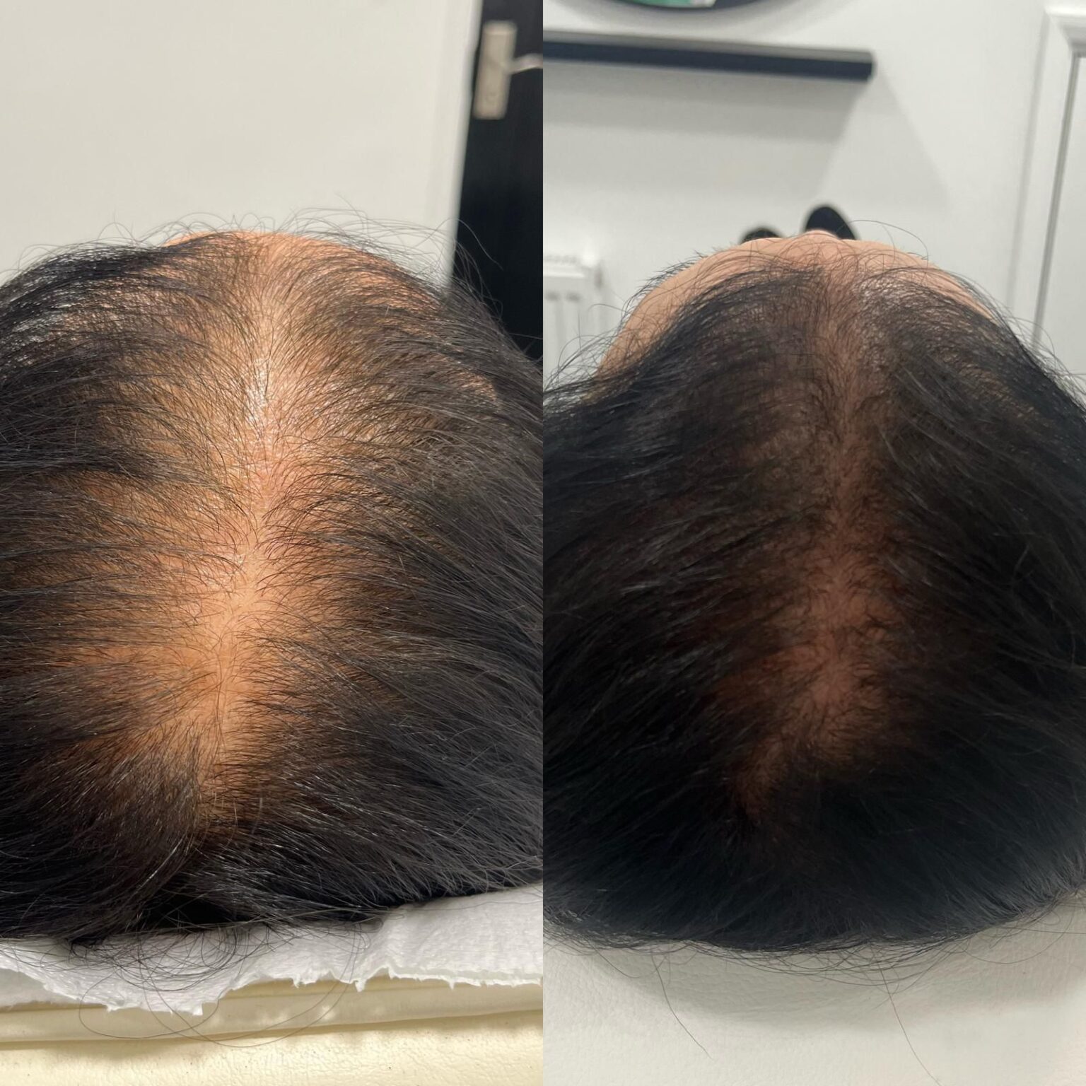 Home Regenerative Treatments in Ruislip