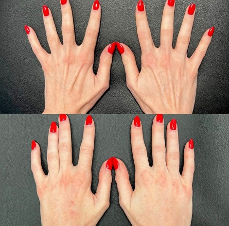 Home adavance-hand-treatment