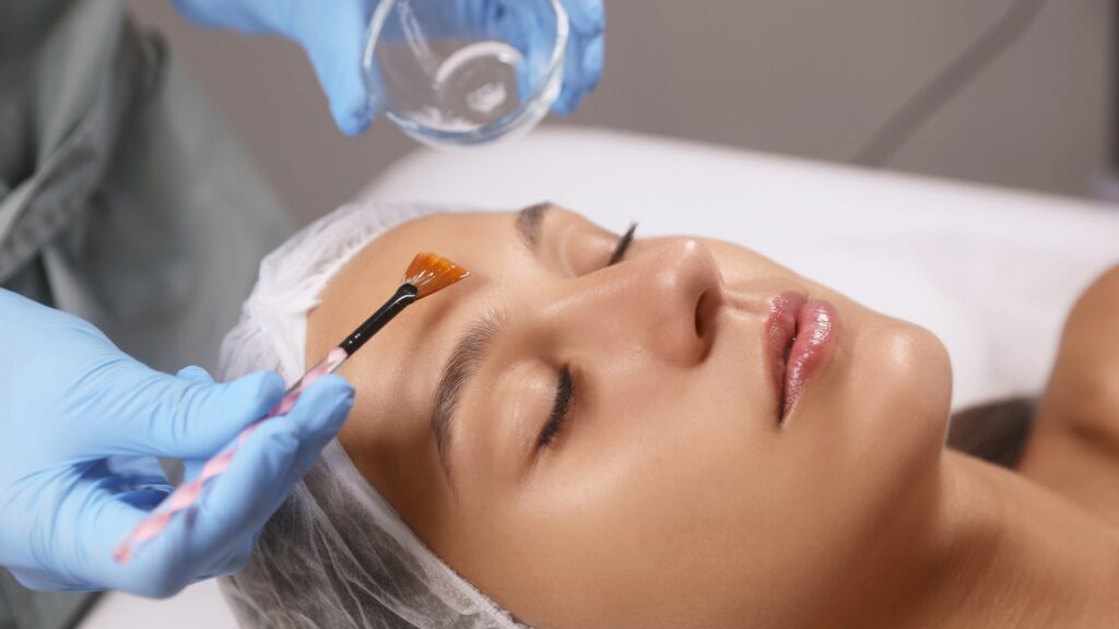 chemical-peeling-Medcura-Clinic