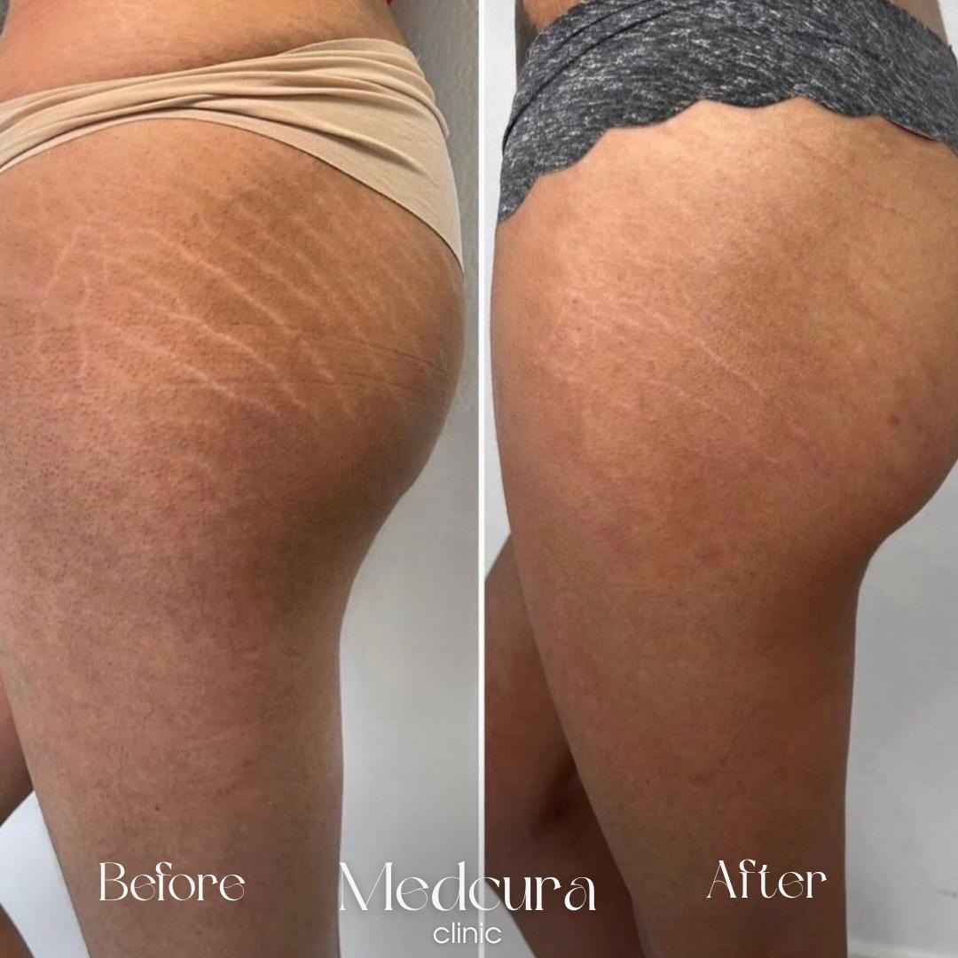 medcura