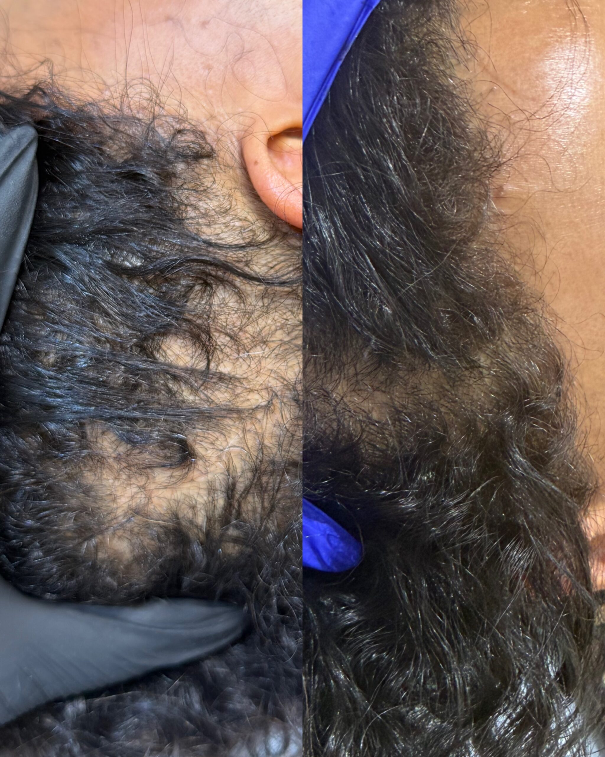 Hair Loss Treatments Medcura stanmore client results male