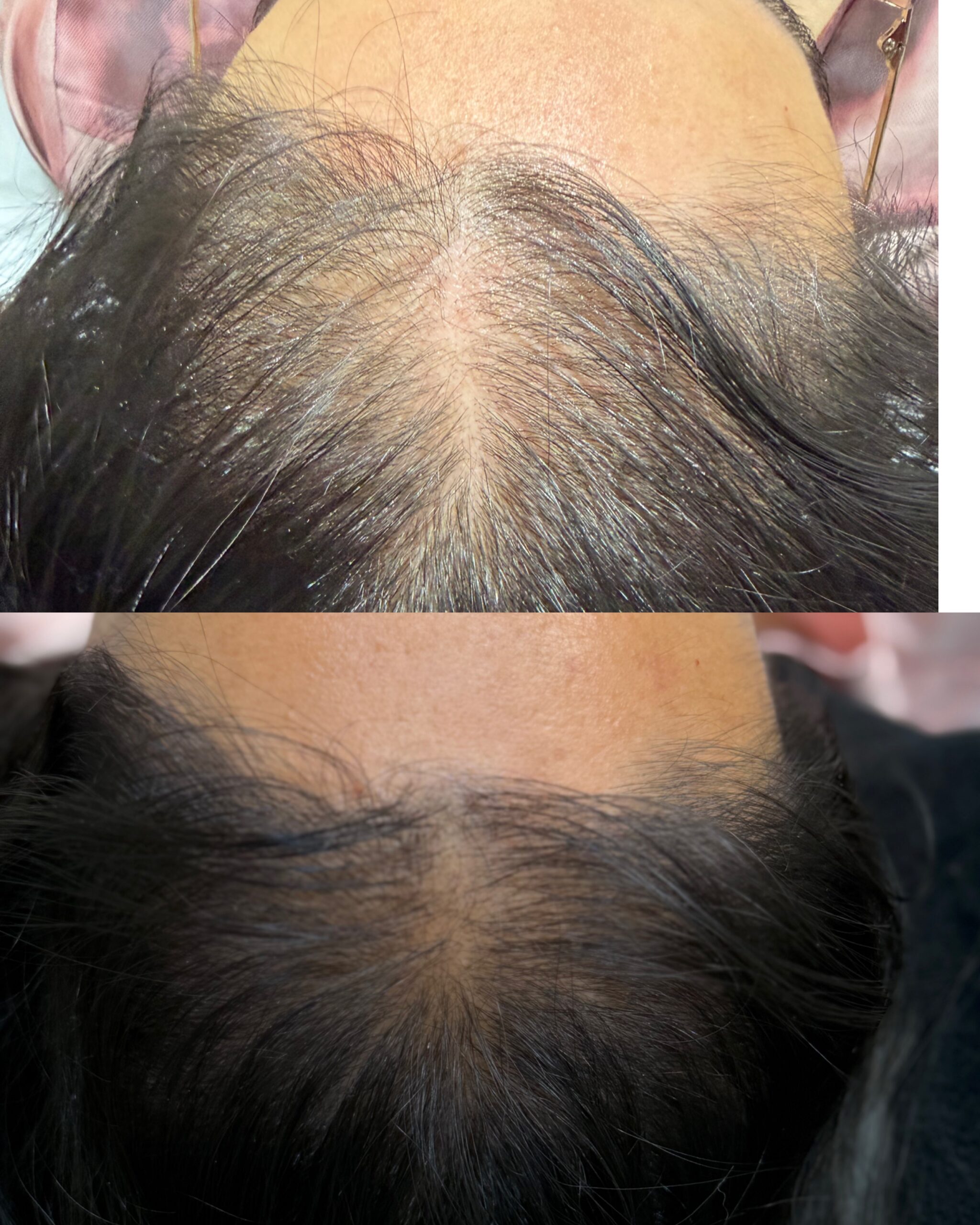 Hair Loss Treatments Medcura stanmore client results